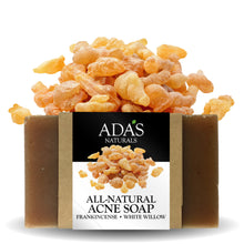 Load image into Gallery viewer, Ada&#39;s Naturals - All-Natural Acne Bar Soap - Frankincense • White Willow (3.5 oz / 99g)
