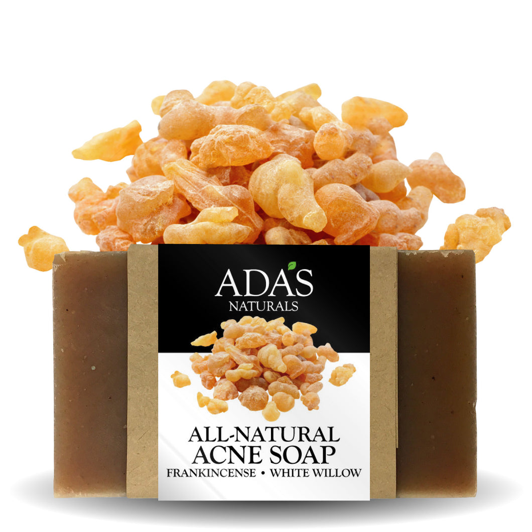 Ada's Naturals - All-Natural Acne Bar Soap - Frankincense • White Willow (3.5 oz / 99g)